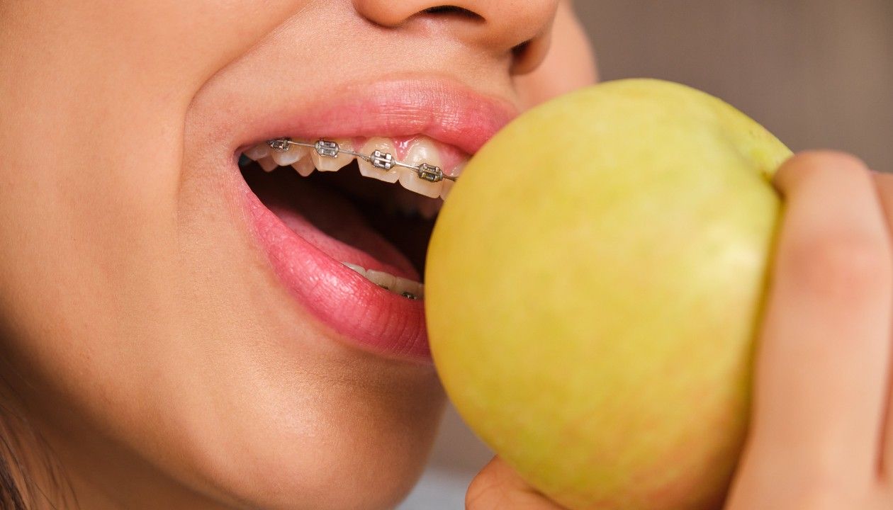 What to eat with braces, the first week: New Braces Meal Plan